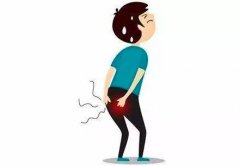 治療肛門(mén)瘙癢手術(shù)費(fèi)用多少錢(qián)